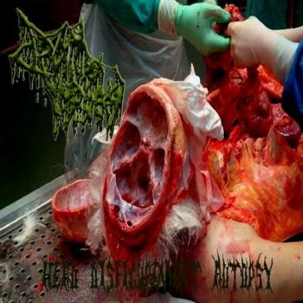 Head Disfigurement Autopsy