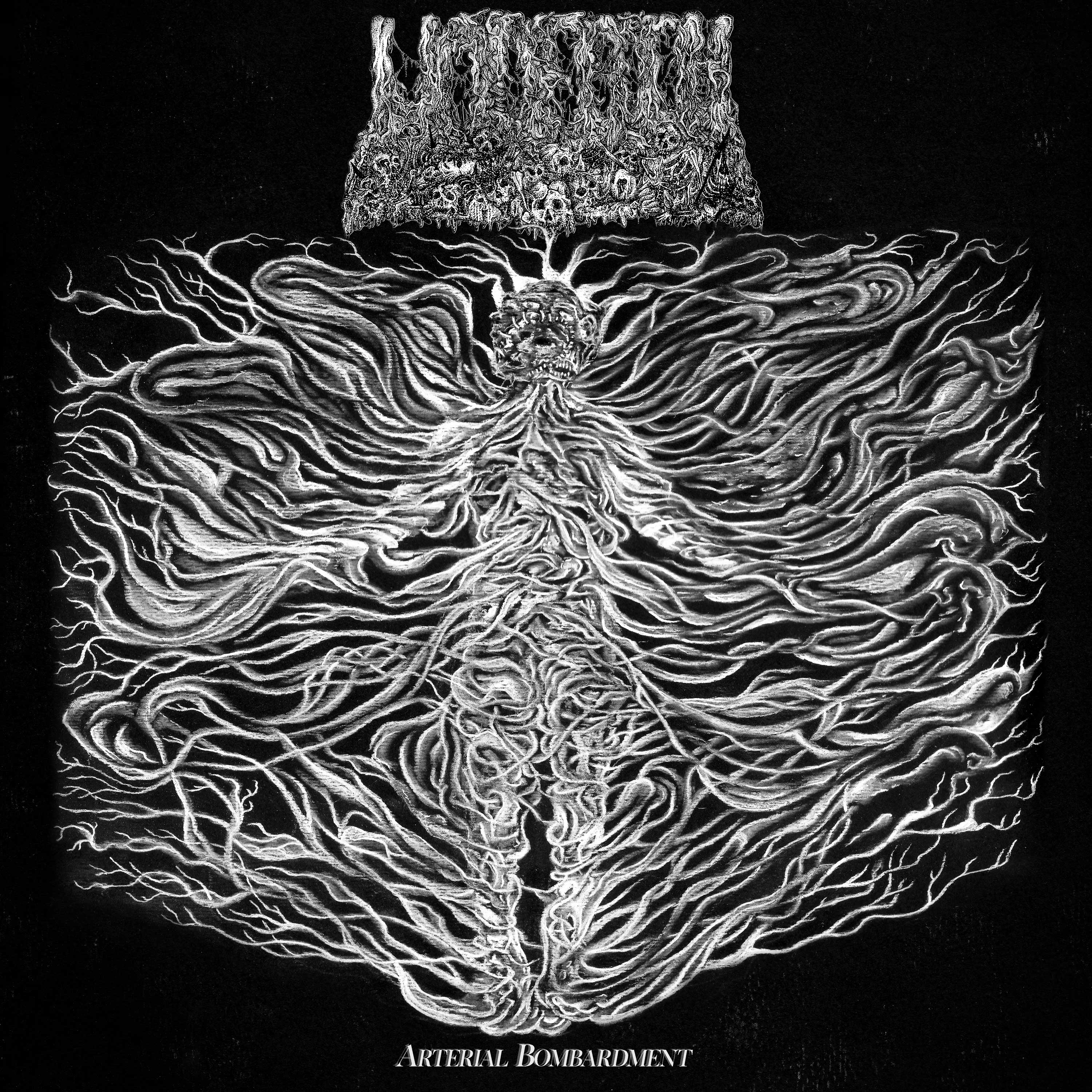 Arterial Bombardment (Single)