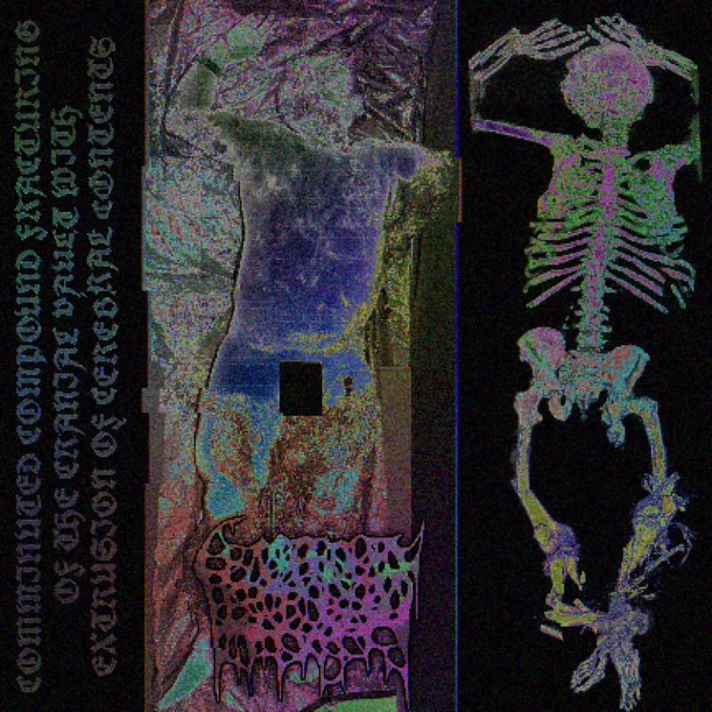 Comminuted Compound Fracturing of the Cranial Vault with Extrusion of Cerebral Contents