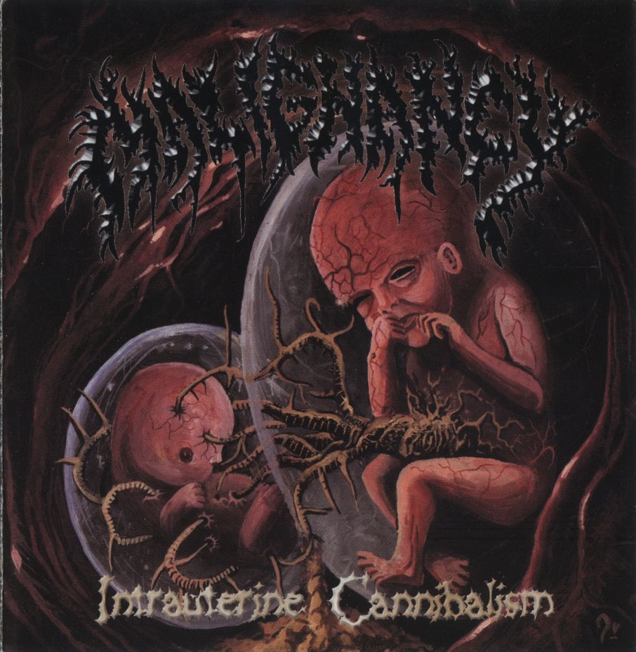 Intrauterine Cannibalism