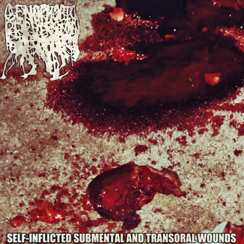 Self-Inflicted Submental and Transoral Wounds